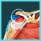 Rotator Cuff Repair